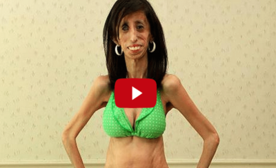 They Called Her “The World’s Ugliest Girl” & Her Response is Unbelievably Beautiful. I literally cried.